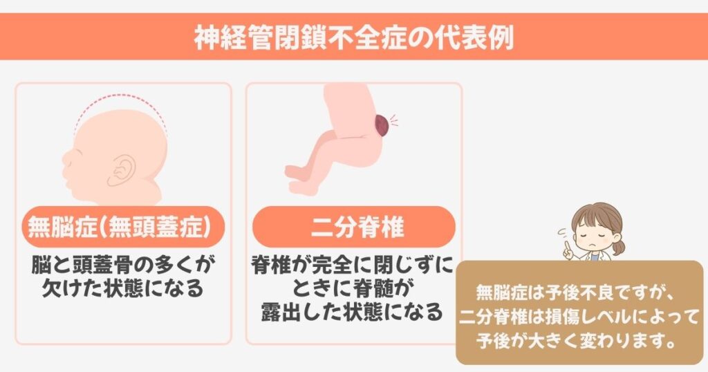 神経管閉鎖不全症の分類