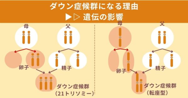 ダウン症候群を生む人の特徴